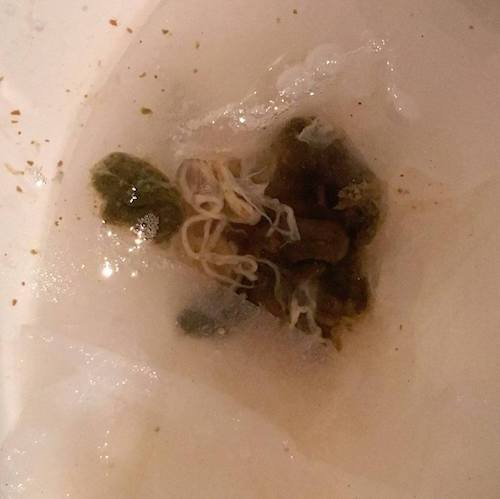 pin worms on poop