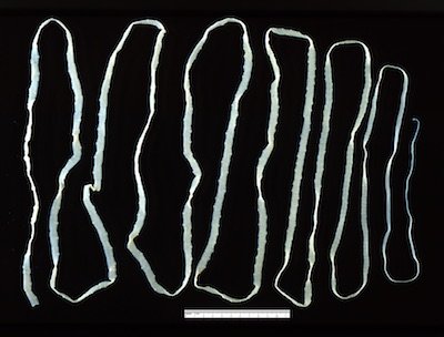 Human Tapeworm