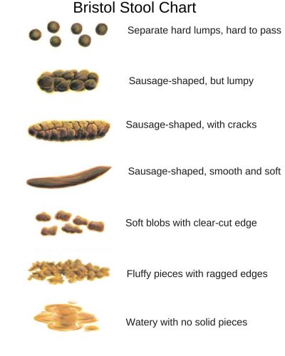 The Bristol Stool Chart