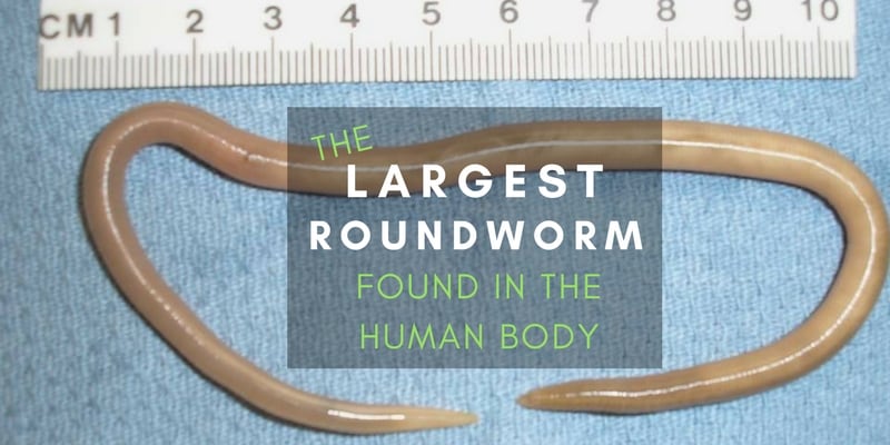 Ascaris The Largest Roundworm Are There Worms Living In Your Gut | Free ...