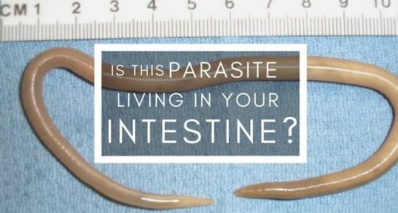 Parasites Archives - OM Detox